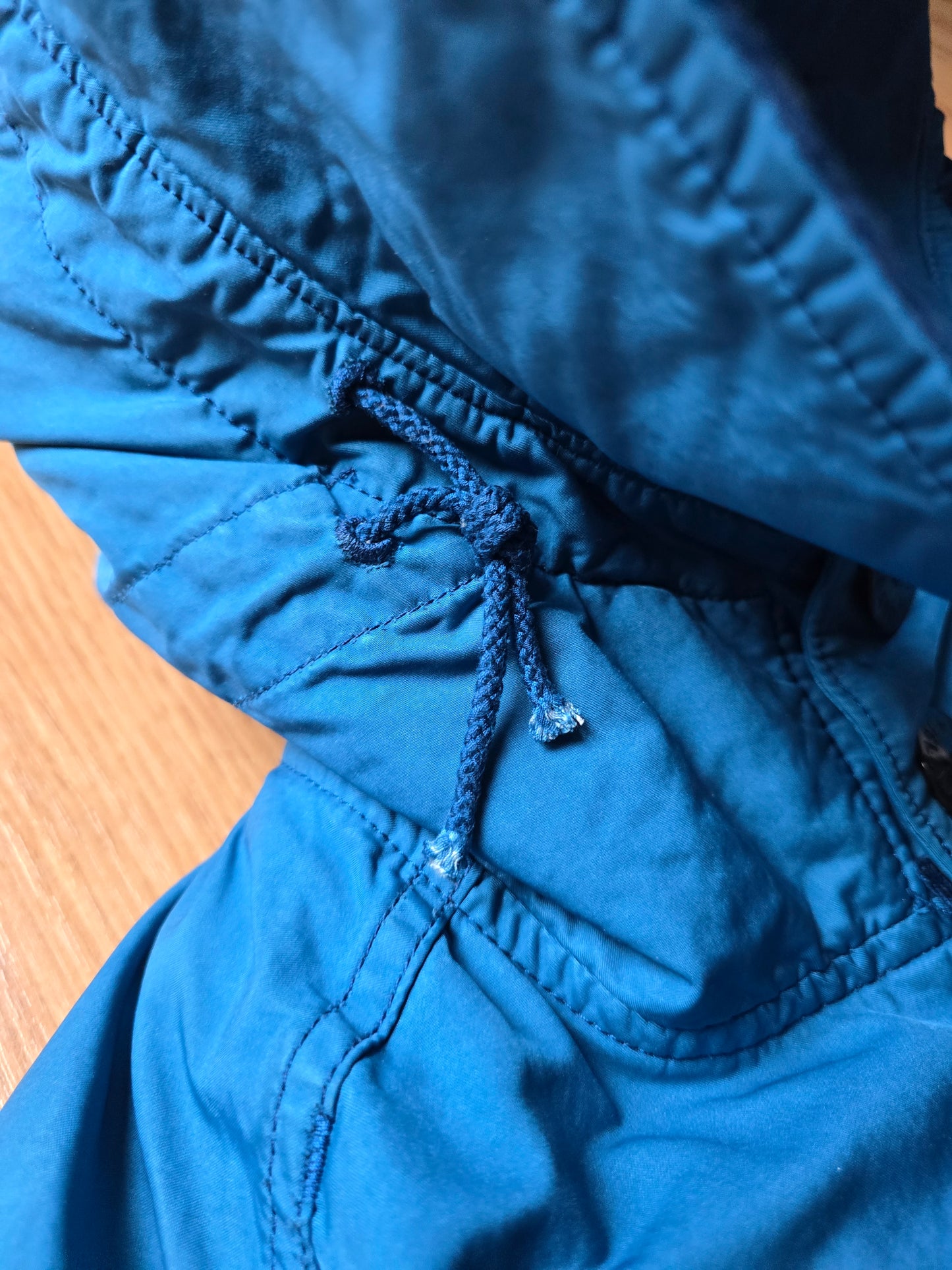 Stone Island David TC Removable Down Lined Parka Jacket (M)